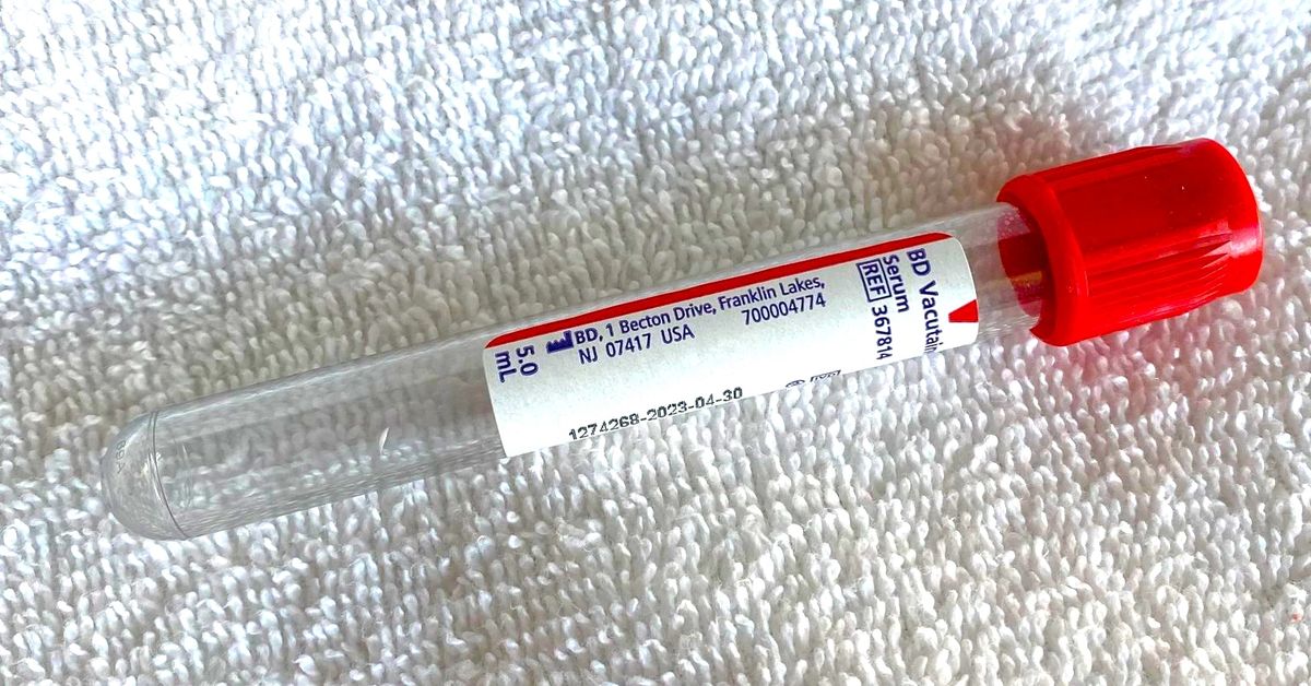 BD vacutainer 5mL Red Top serum blood collection tube